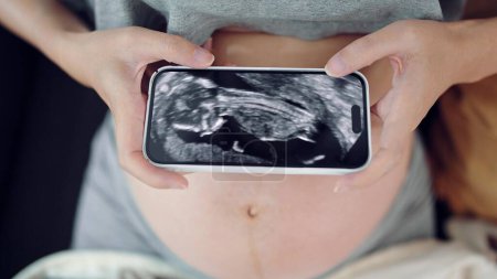 Foto de Mujeres embarazadas que buscan ultrasonido video de su bebé en el teléfono inteligente. Cerrar vídeo de ultrasonido en el teléfono inteligente. Embarazo del tercer trimestre. Ginecología nacimiento parto, concepto de embarazo - Imagen libre de derechos