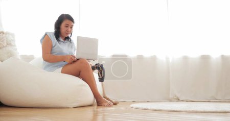 Foto de Las mujeres felices en la pierna prótesis de trabajo y mecanografía en el ordenador portátil mientras se sienta en la sala de estar en casa. Mujeres con prótesis en la pierna trabajando en el portátil. Equipos protésicos para piernas, concepto de amputado - Imagen libre de derechos