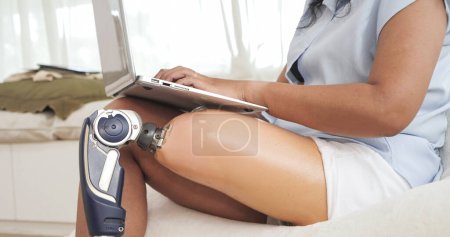 Foto de Cierre la pierna protésica de las mujeres amputadas trabajando y escribiendo en el ordenador portátil mientras están sentadas en la sala de estar en casa. Equipos protésicos para piernas, concepto de amputado - Imagen libre de derechos