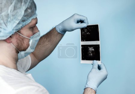 Foto de En el hospital, el médico urólogo analiza el ultrasonido del riñón de una persona, un cálculo o un cálculo en el riñón en un ultrasonido en las manos del médico. Enfermedad del tracto urinario masculino. Cálculo en el uréter oxalato 8 mm. Asistencia sanitaria. - Imagen libre de derechos