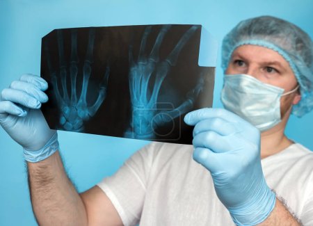 Docteur traumatologue otopé analyse la blessure du poignet d'une personne. Radiographie des doigts du médecin dans ses mains au bureau. Le médecin analyse la blessure à la main endommagée. Perle des doigts