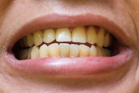 Foto de Los dientes de un hombre son amarillos - Imagen libre de derechos