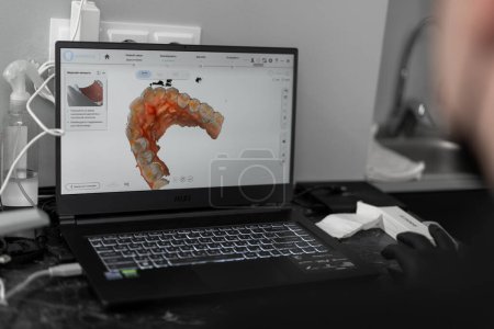 Foto de Exploración dental 3D de los dientes del paciente en la pantalla - Imagen libre de derechos