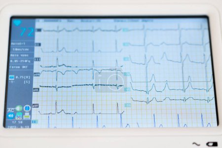 Foto de Cardiólogo muestra la pantalla de una tableta digital con el resultado de un cardiograma del corazón de un paciente en la clínica - Imagen libre de derechos