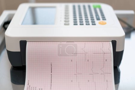 Téléchargez les photos : Un cardiologue fait un cardiogramme ECG pour un patient imprime une analyse du pouls et du rythme cardiaque du patient dans la clinique - en image libre de droit