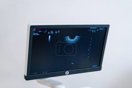 Photo for Medical office with ultrasound diagnostic equipment in health clinic gynecological office - Royalty Free Image