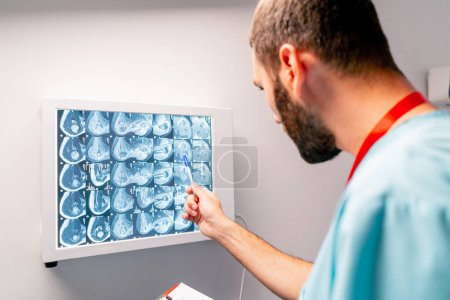 Photo for The radiologist carefully studies the MRI image on a special board describes what he saw and writes a diagnosis conclusion - Royalty Free Image