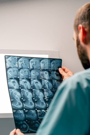 Photo for A close-up frame of an MRI image on a special board for an accurate and detailed a description of image and diagnosis - Royalty Free Image