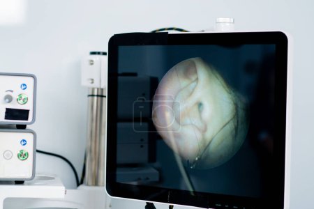 Foto de Primer plano del procedimiento de endoscopia del conducto auditivo una imagen de los oídos en la pantalla del dispositivo en la clínica - Imagen libre de derechos