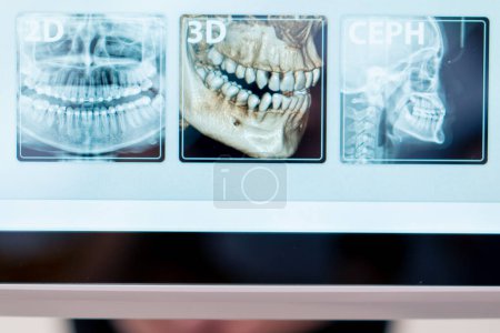 Photo for Close-up 3D shot of a scan of the jaw of the oral cavity and head on a screen in clinic - Royalty Free Image