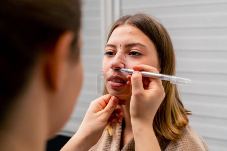 Téléchargez les photos : Un chirurgien plasticien fait des marques sur le visage d'un patient lors d'une consultation avant l'opération du nez - en image libre de droit