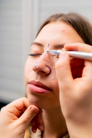 Foto de Primer plano cirujano plástico hace marcas en la cara de un paciente durante una consulta antes de la operación de la nariz - Imagen libre de derechos