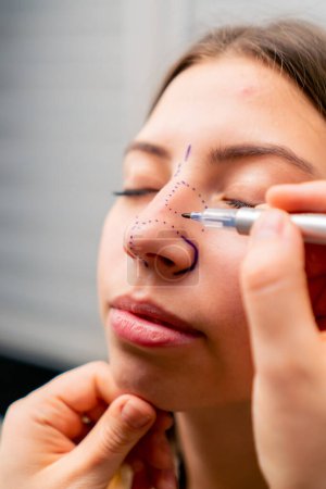 Photo for Close-up plastic surgeon makes marks on a patient's face during a consultation before nose operation - Royalty Free Image