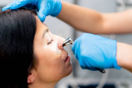 Foto de Primer plano médico ENT examina la cavidad nasal del paciente en el consultorio de la clínica con herramientas profesionales - Imagen libre de derechos
