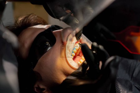 Photo for Close up dental up office girl dentist applies protective gel to the gums of a young guy - Royalty Free Image