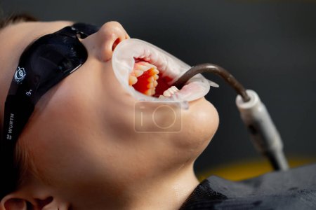 Téléchargez les photos : Gros plan dans le cabinet dentaire d'une jeune belle fille avec un spéculum dans la bouche et des lunettes noires - en image libre de droit