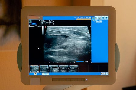 Foto de Inyección intermedia en un cribado de una clínica veterinaria en un monitor de ultrasonido abdominal - Imagen libre de derechos