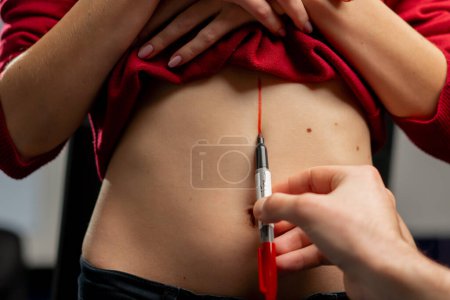 Téléchargez les photos : Gros plan dans une clinique de chirurgie plastique médecin fait des marques sur le ventre d'une jeune fille avant la chirurgie - en image libre de droit