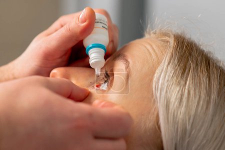 Nahaufnahme in einer Augenklinik Gefriertropfen werden einem Mädchen ins Auge gesetzt