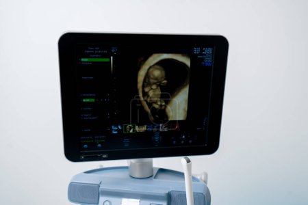 Téléchargez les photos : Gros plan dans le cabinet gynécologique clinique un moniteur de dépistage durée de la grossesse - en image libre de droit