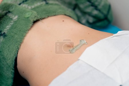 Photo for Close-up in a gynecological clinic a patient is lying on a couch being checked by a doctor for an ultrasound - Royalty Free Image