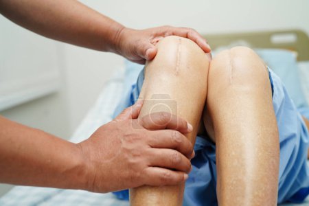 Médecin vérifier asiatique femme âgée patient avec cicatrice genou chirurgie de remplacement à l'hôpital.