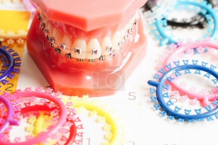 Photo for Orthodontic ligatures rings and ties, elastic rubber bands on orthodontic braces, model for dentist studying about dentistry. - Royalty Free Image