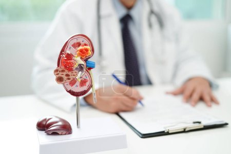 Photo for Chronic kidney disease, doctor with model for treatment urinary system, urology, Estimated glomerular filtration rate eGFR. - Royalty Free Image