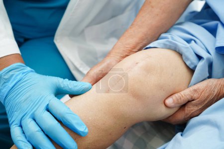 Foto de Médico revisando paciente anciana asiática con cicatriz cirugía de reemplazo de rodilla en el hospital. - Imagen libre de derechos