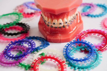 Photo for Orthodontic ligatures rings and ties, elastic rubber bands on orthodontic braces, model for dentist studying about dentistry. - Royalty Free Image