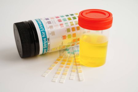 Foto de Análisis de orina, taza de orina con tira de reactivo prueba de papel pH y tabla de comparación en laboratorio. - Imagen libre de derechos