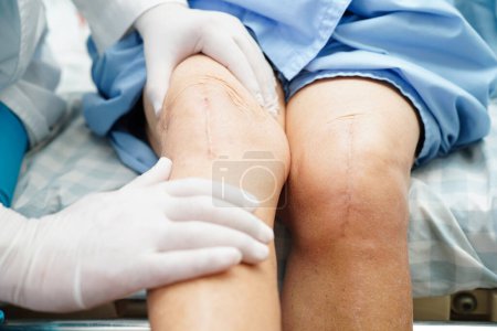 Photo for Doctor checking Asian elderly woman patient with scar knee replacement surgery in hospital. - Royalty Free Image
