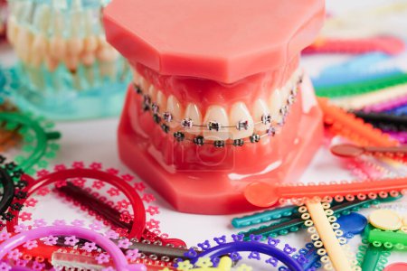 Anillos y lazos de ligaduras ortodóncicas, bandas elásticas de goma en ortodoncia, modelo para dentista que estudia odontología.
