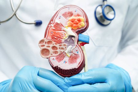 Enfermedad renal crónica, médico con modelo para el tratamiento del sistema urinario, urología, tasa estimada de filtración glomerular eGFR.