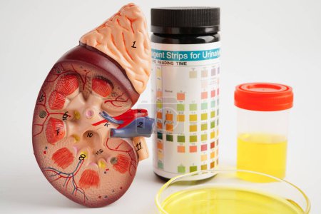 Urinalysis, Kidney and urine cup for check health examination in laboratory.