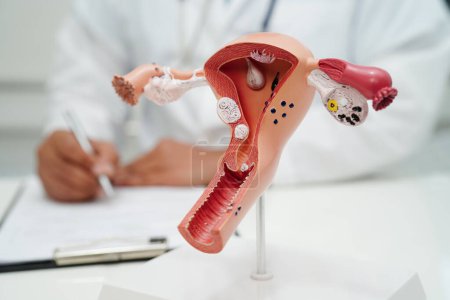 Utérus, médecin tenant un modèle d'anatomie humaine pour le diagnostic et le traitement de l'étude à l'hôpital.