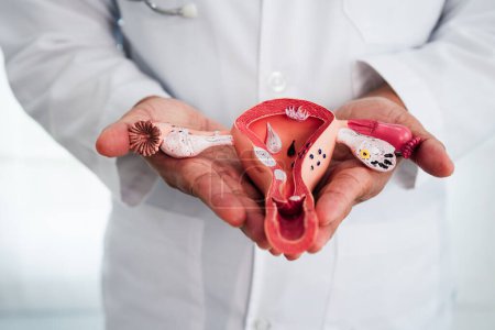 Uterus, doctor holding human anatomy model for study diagnosis and treatment in hospital.