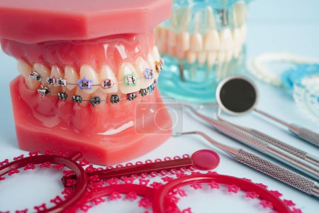 Anneaux et attaches de ligatures orthodontiques, élastiques élastiques sur orthèses orthodontiques, modèle pour dentiste étudiant la dentisterie.