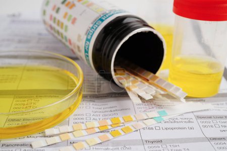 Urinalysis, urine cup with reagent strip pH paper test and comparison chart in laboratory.