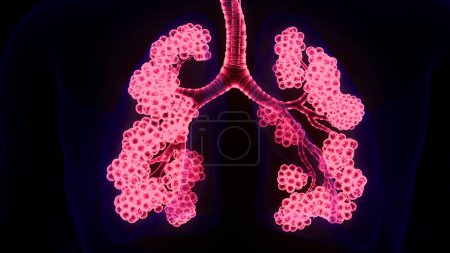 Téléchargez les photos : Appareil respiratoire humain Poumons avec anatomie des alvéoles. 3D - en image libre de droit