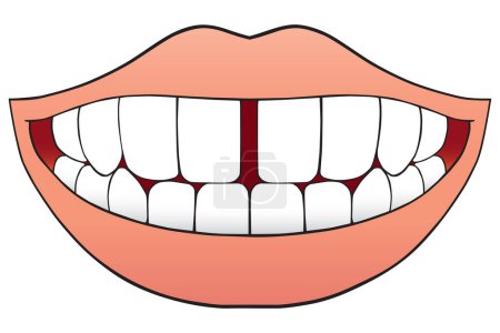 Illustration for A smiling mouth with a gap between the two front teeth - Royalty Free Image