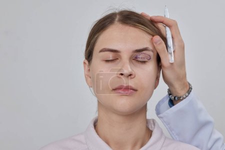 Blepharoplastik einer Frau, die vor einer plastischen Operation eine Markierung im Gesicht hat, um die Augenpartie in einer medizinischen Klinik zu verändern