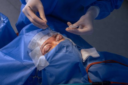 Téléchargez les photos : Yeux rapprochés après chirurgie oculaire, opération de blépharoplastie, chirurgien plasticien - en image libre de droit