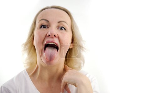 Foto de A woman shows her tongue healthy clean tongue result of cleaning the tongue. Female tongue with a white coating. isolated on white background. Gastrointestinal disease - Imagen libre de derechos