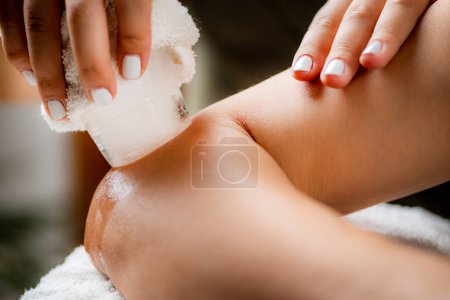 Téléchargez les photos : Massage sur glace pour le coude douloureux. Mains d'un thérapeute plaçant de la glace directement sur un coude douloureux pour soulager la douleur, réduire l'inflammation et le gonflement et favoriser la guérison. - en image libre de droit