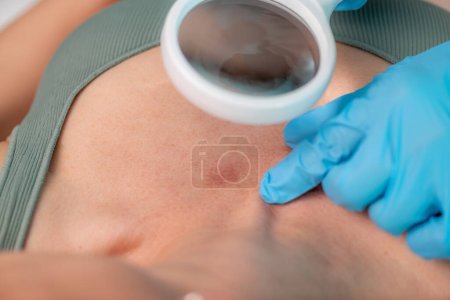 Photo for Dermatologist examining skin lesions revealing crucial insights for accurate diagnosis and personalized care. - Royalty Free Image