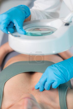 Photo for Dermatologist examining the skin under a dermatology magnifying lamp providing detailed information about the skin's condition. - Royalty Free Image