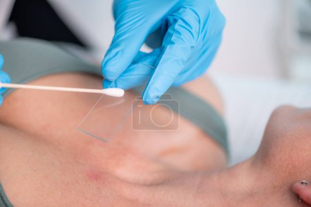 Photo for Dermatologist carefully takes sample and examines a patient's skin for potential fungal infections, places the swab sample onto a glass slide. - Royalty Free Image
