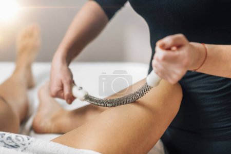 Foto de Metal Roling Pin Anti-celulitis Tratamiento. Un masajista trata el área afectada por la celulitis con un rodillo de metal - Imagen libre de derechos