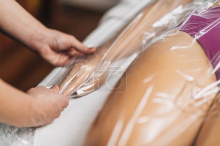 Foto de Anti-celulitis embolsando terapia de vacío para brazos y piernas. Cliente femenino acostado en una mesa de masaje en un centro de bienestar de belleza, brazos y piernas en una bolsa de nylon. - Imagen libre de derechos